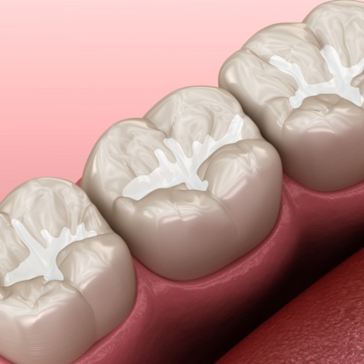 Animated row of teeth with dental sealants placed by children's dentist in Merrillville